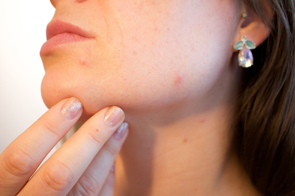 woman checking skin